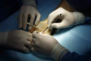 Ortopedia e chirurgia della mano a Padova