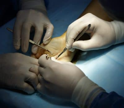 Ortopedia e chirurgia della mano a Padova